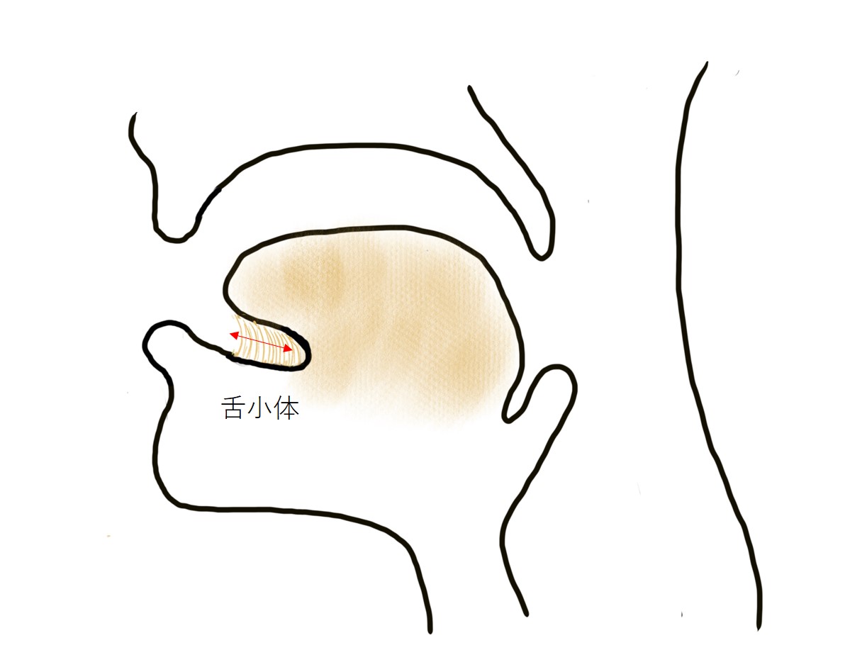 新生児・乳児の外科疾患：舌小体短縮症（ぜつしょうたいたん