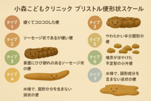 ブリストルスケール