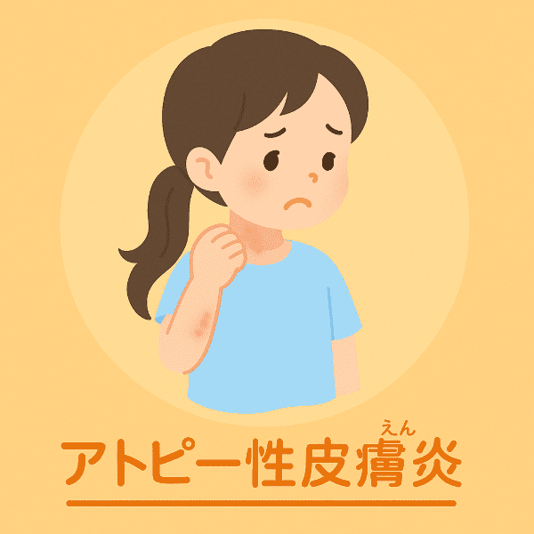 アトピー性皮膚炎