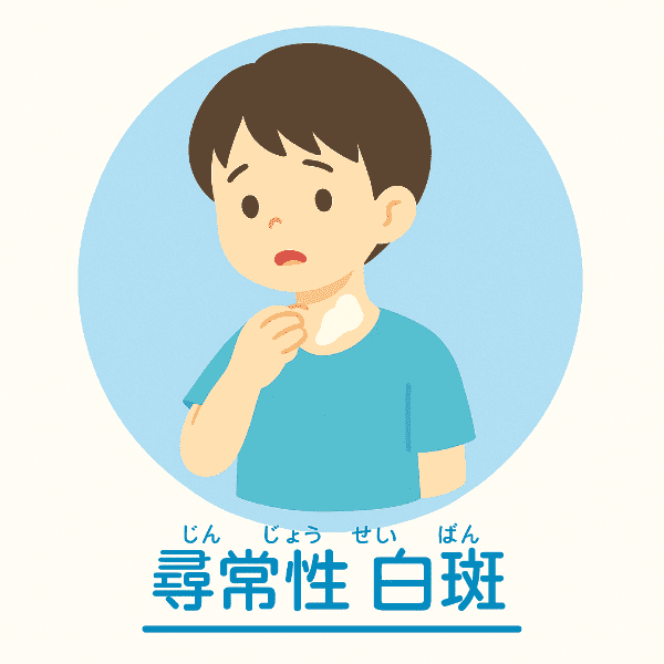 尋常性白斑