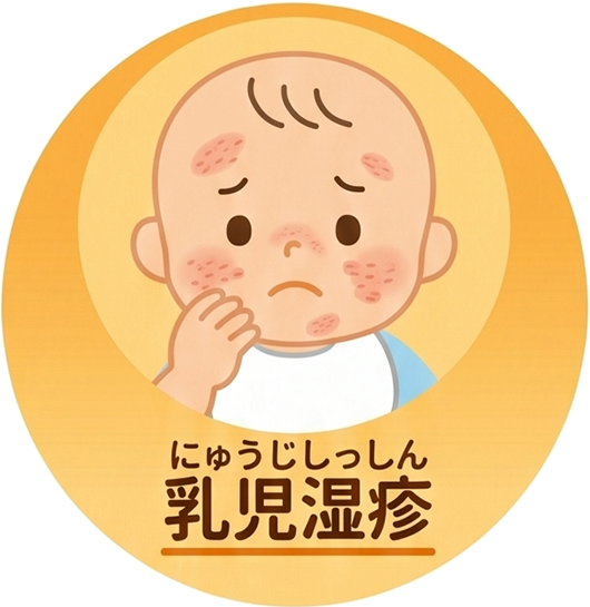 乳児湿疹