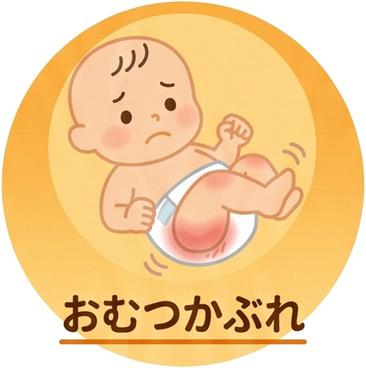 おむつかぶれ