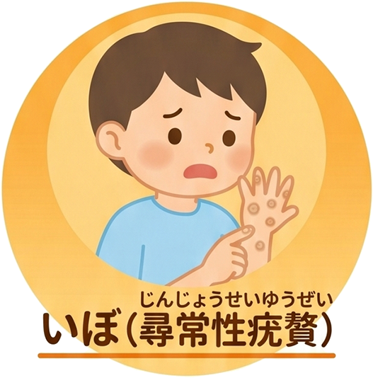 いぼ
