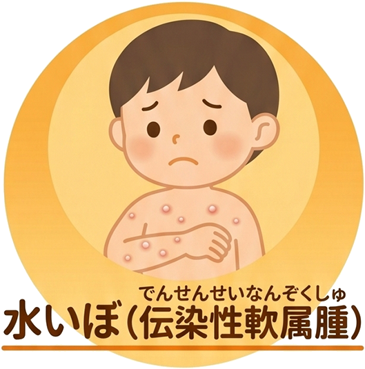 水いぼ