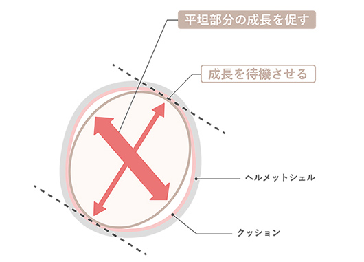 ベビーバンド